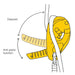 Illustration of the anti-panic function on the Petzl ID S Descender which automatically stops the descent if the user pulls too hard on the handle.